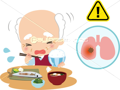 食事中にむせるシニア女性と肺炎のイメージの写真 イラスト素材 Xf ペイレスイメージズ