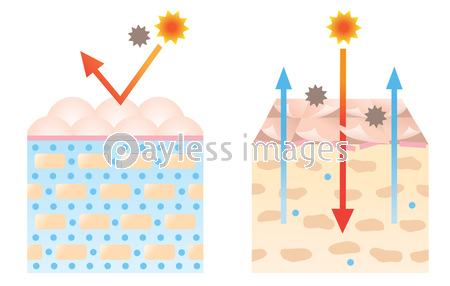 肌断面図 セラミド 健康な肌 乾燥肌 ストックフォトの定額制ペイレスイメージズ