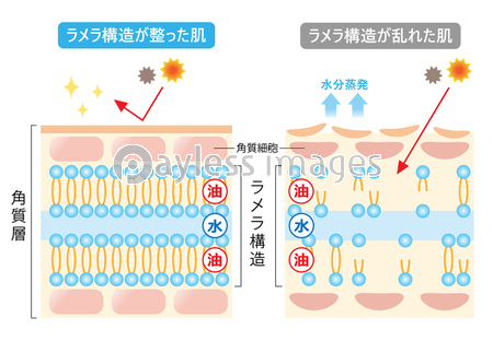 ラメラ構造 肌の断面図 ストックフォトの定額制ペイレスイメージズ