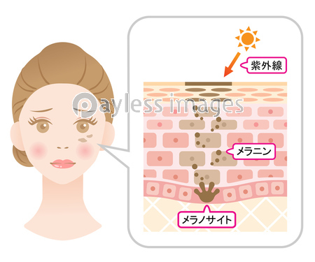 ラメラ構造が乱れた肌 断面図 商用利用可能な写真素材 イラスト素材ならストックフォトの定額制ペイレスイメージズ