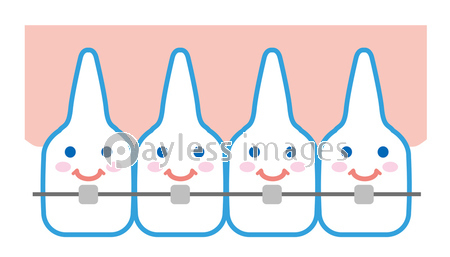 歯並び 歯列矯正 イラスト ストックフォトの定額制ペイレスイメージズ